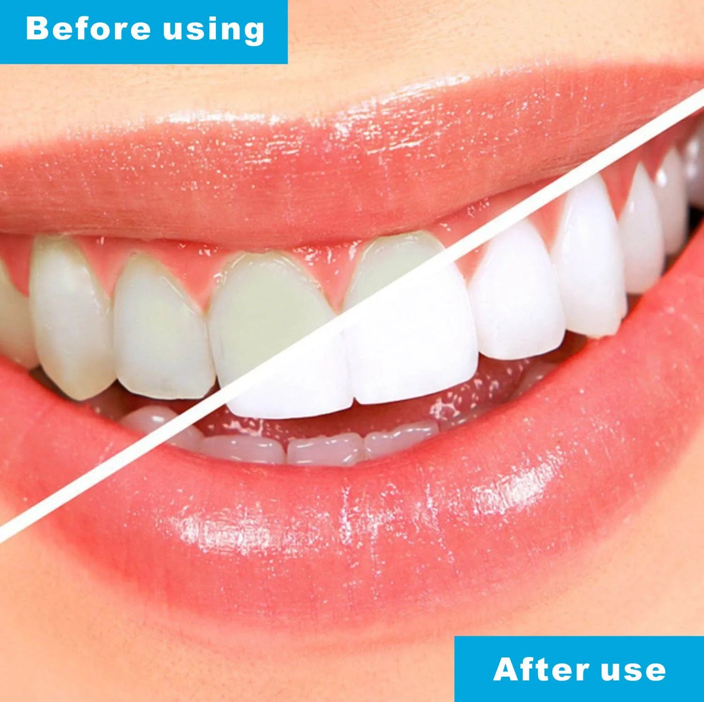 Anti-Snore Mouthpiece & Bruxism Guard