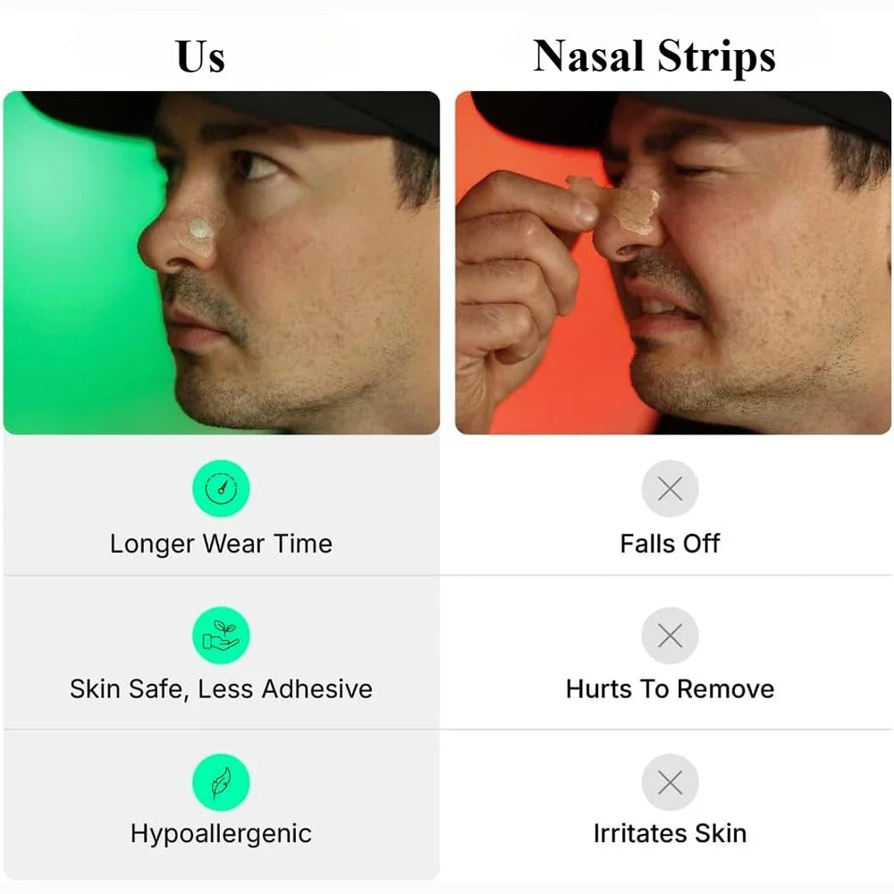 Nasal Breathing Dilators – Anti-Snoring & Sleep Support